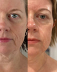 H+ Serum