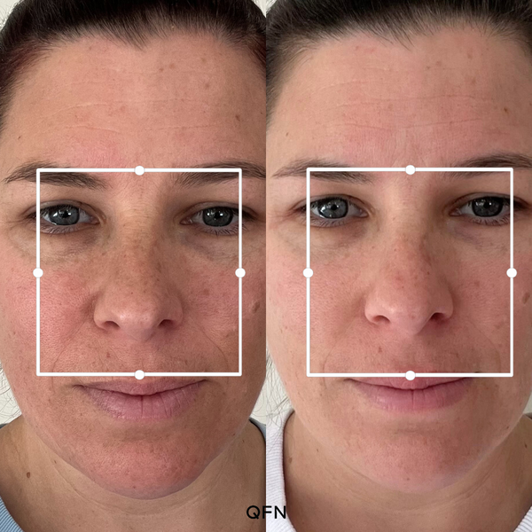 Before and after transformation for Ash H.