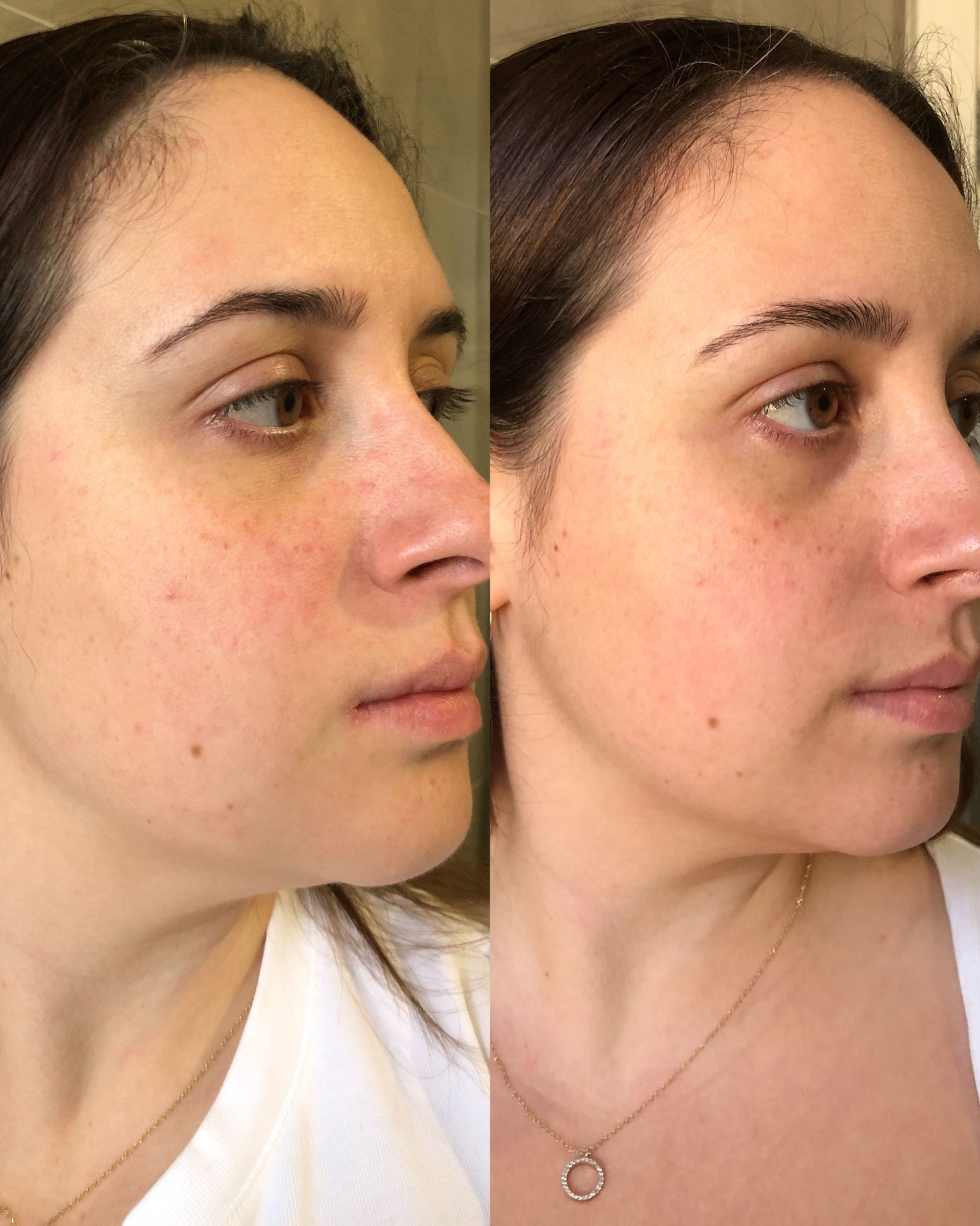 H+ Serum