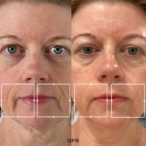 Before and after transformation for Kellie S.