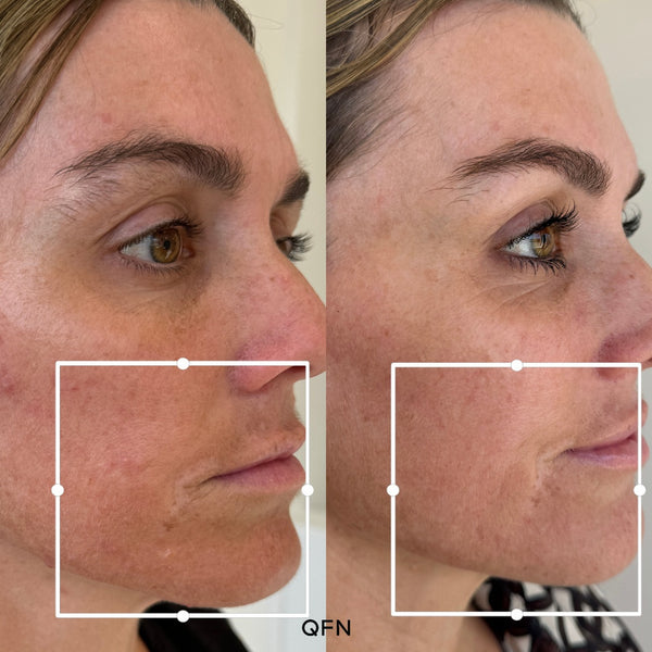 Before and after transformation for Philippa F.