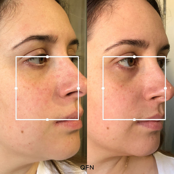 Before and after transformation for Sarah C.