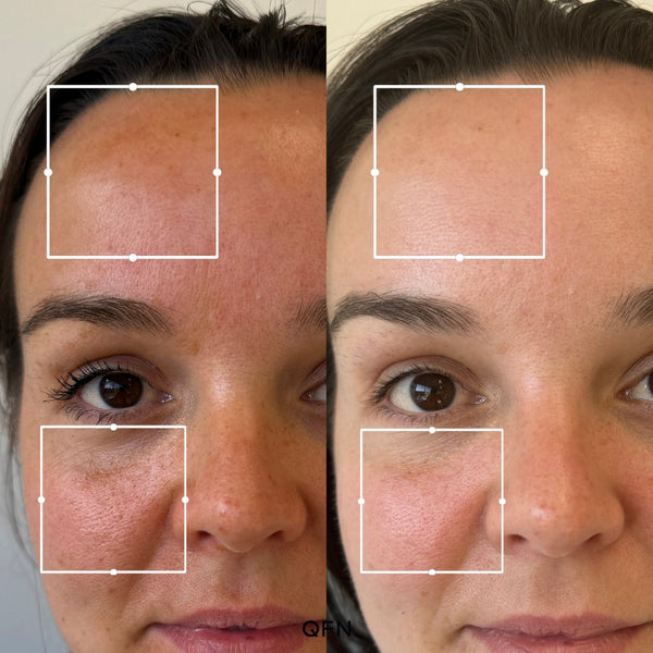 Before and after transformation for Whitney H.